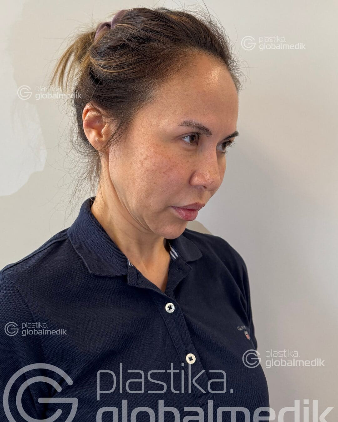 До